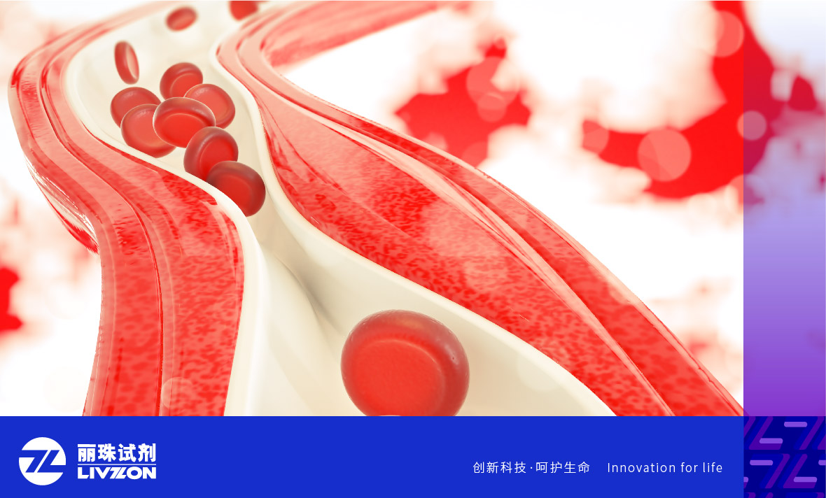 麗科普丨抗磷脂抗體陽(yáng)性能診斷為「 抗磷脂綜合征 」嗎？